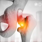 Hip replacement on medical background