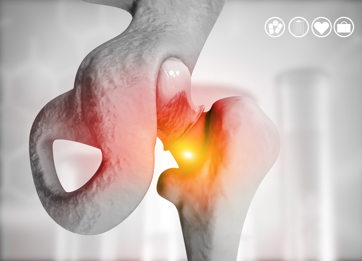 Signs & Symptoms of Metallosis Morris Law Firm Free Consultation